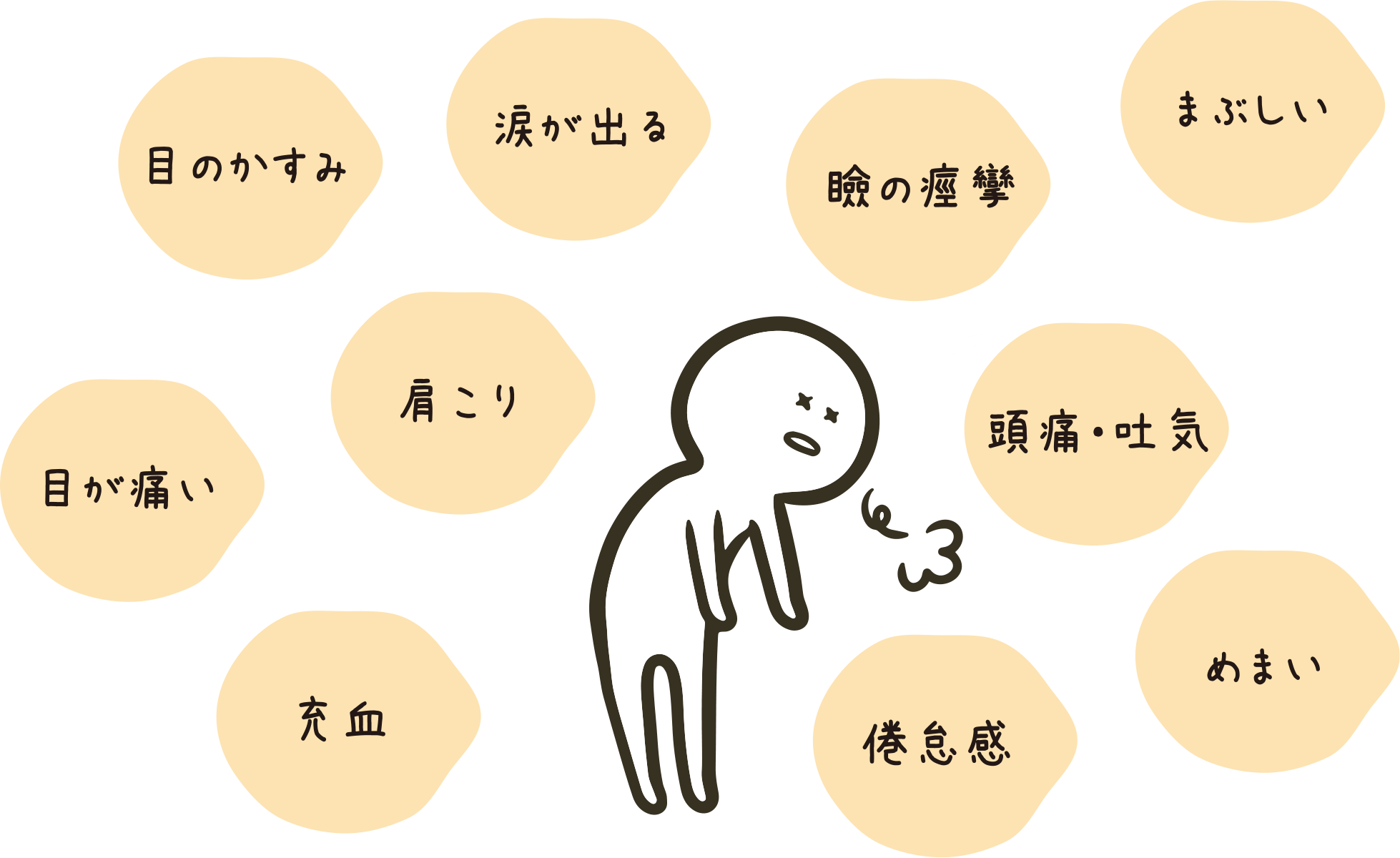 眼精疲労の主な症状？